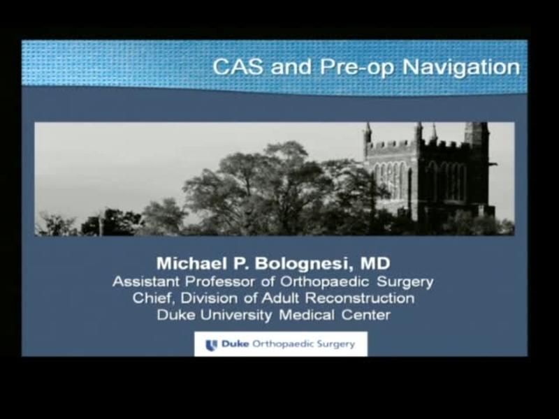 CAS and Pre-Op Navigation