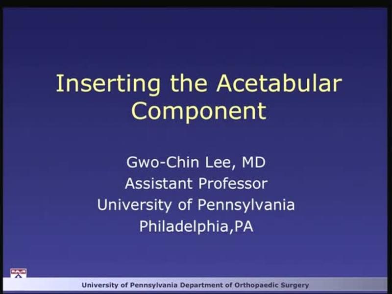Inserting the Acetabular Component
