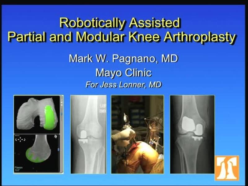 Robotically Assisted Partial and Modular Knee Arthroplasty 