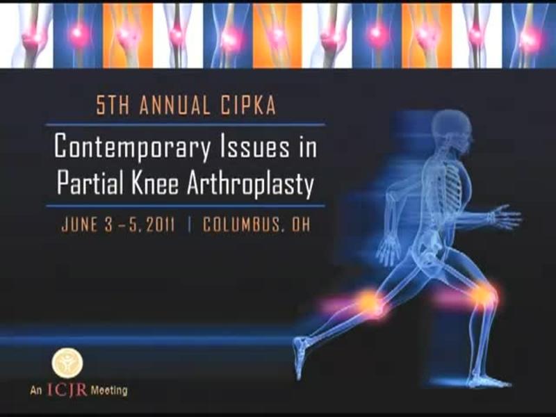 Custom Bicompartmental Knee Arthroplasty