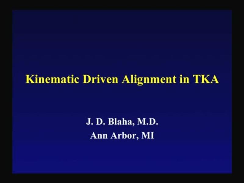 Kinematic Driven Alignment in TKA