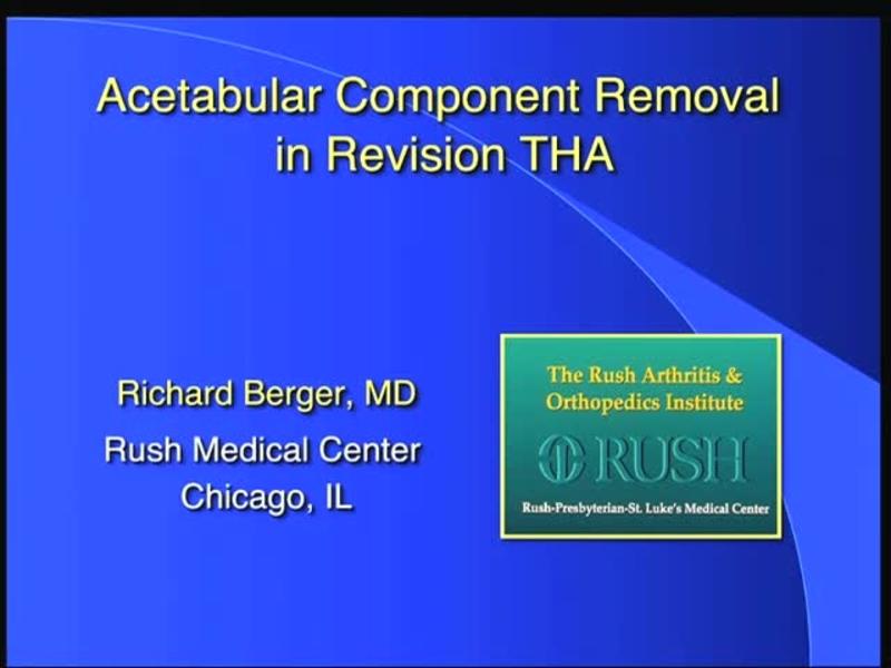 Acetabular Component Removal in Revision THA