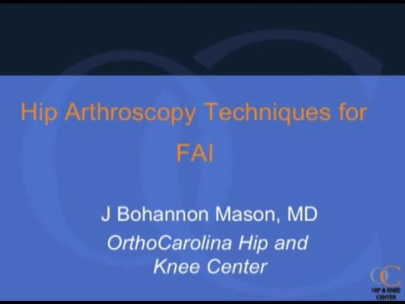 Arthroscopic Decompression Technique 