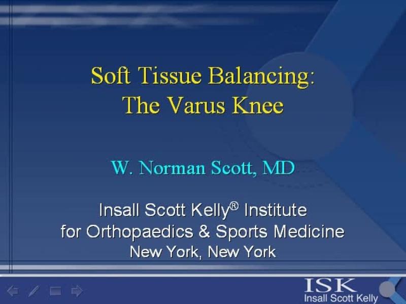 The Varus Knee in Primary TKA