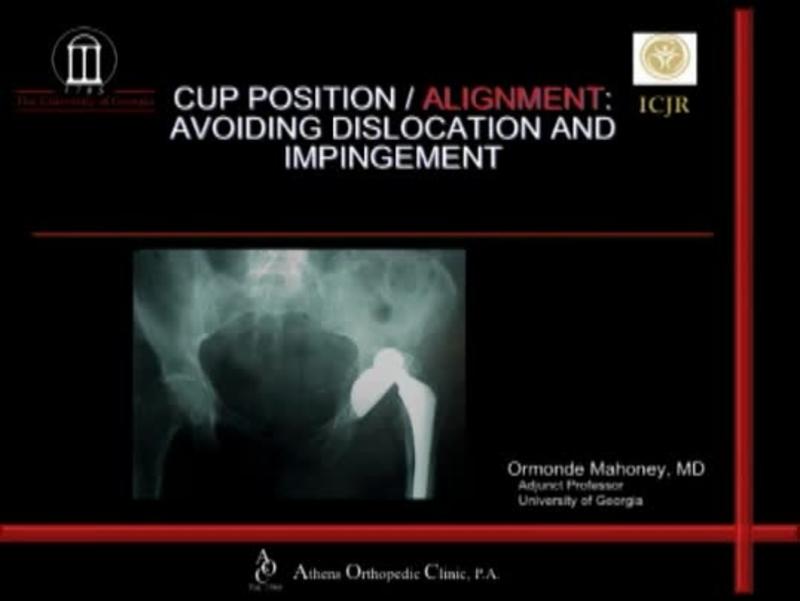 Cup Position - Avoiding Dislocation & Impingement