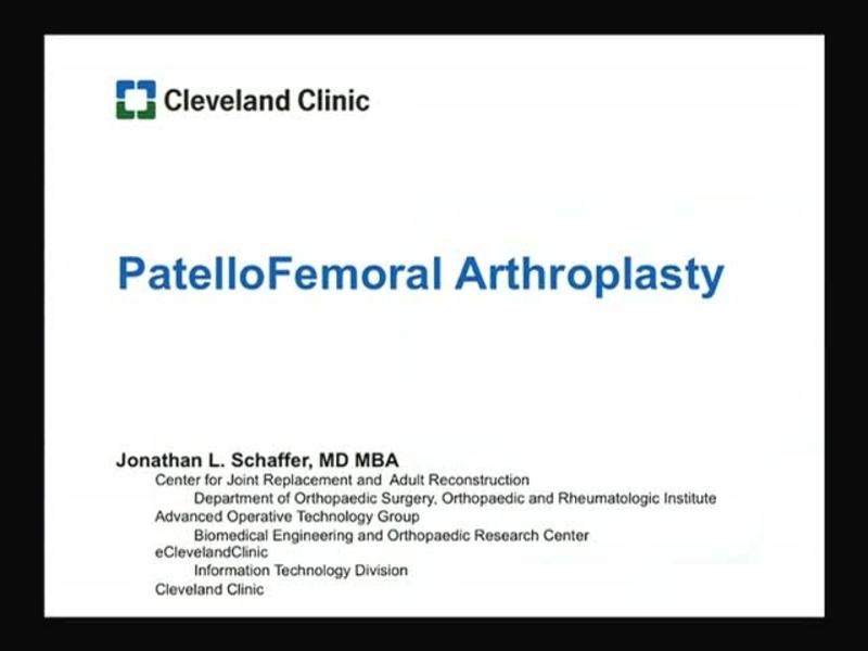 PatellloFemoral Arthroplasty
