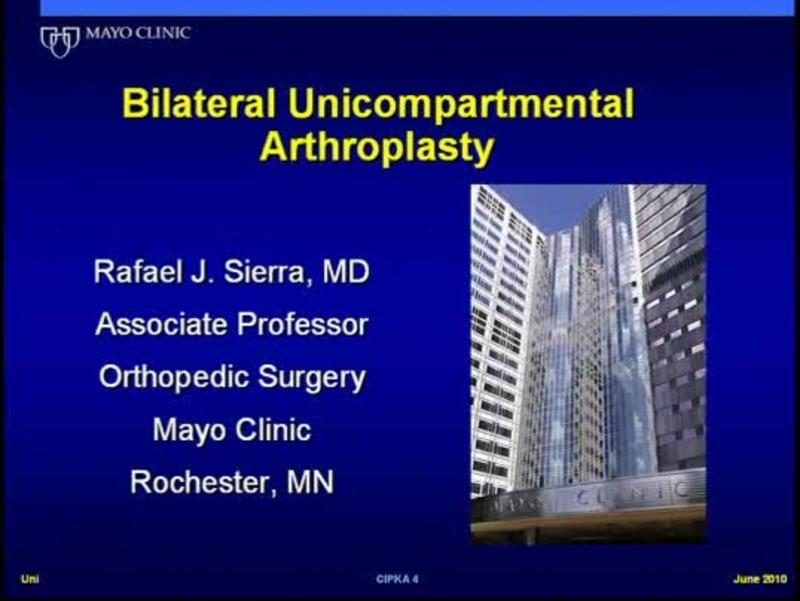 Bilateral Unicompartmental  Arthroplasty
