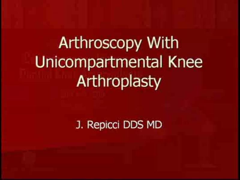 The Role of Peri-Operative Arthroscopy in Partial Knee Arthr
