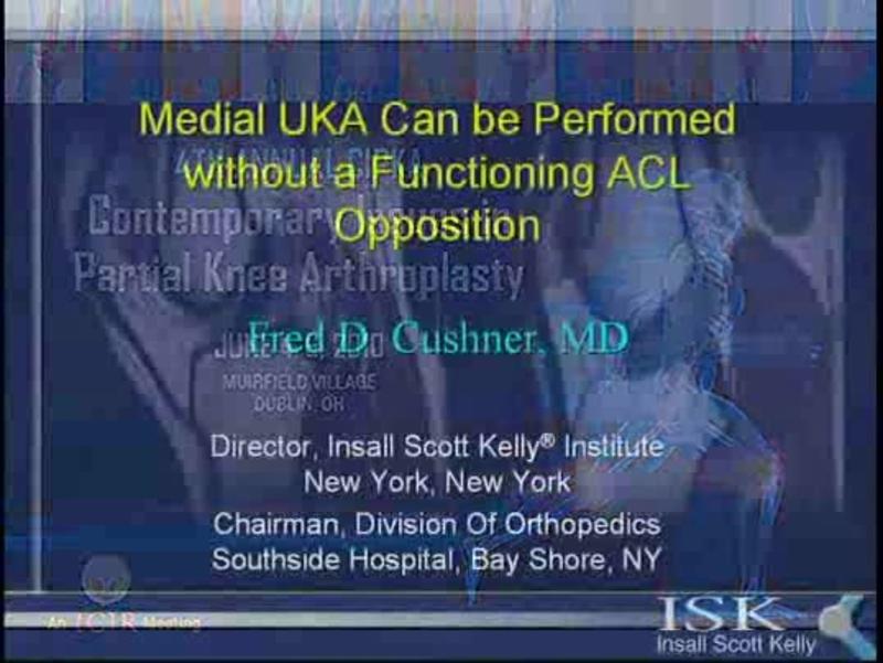 Medial UKA Can be Performed without a Functioning ACL Opposi