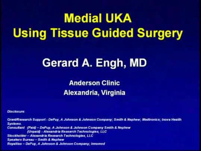 Medial UKA Using Tissue Guided Surgery