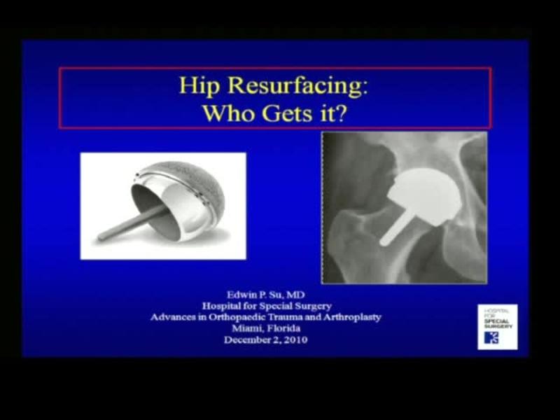 Hip Resurfacing Who Gets It Orthogate